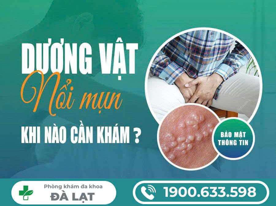 Hình ảnh minh họa